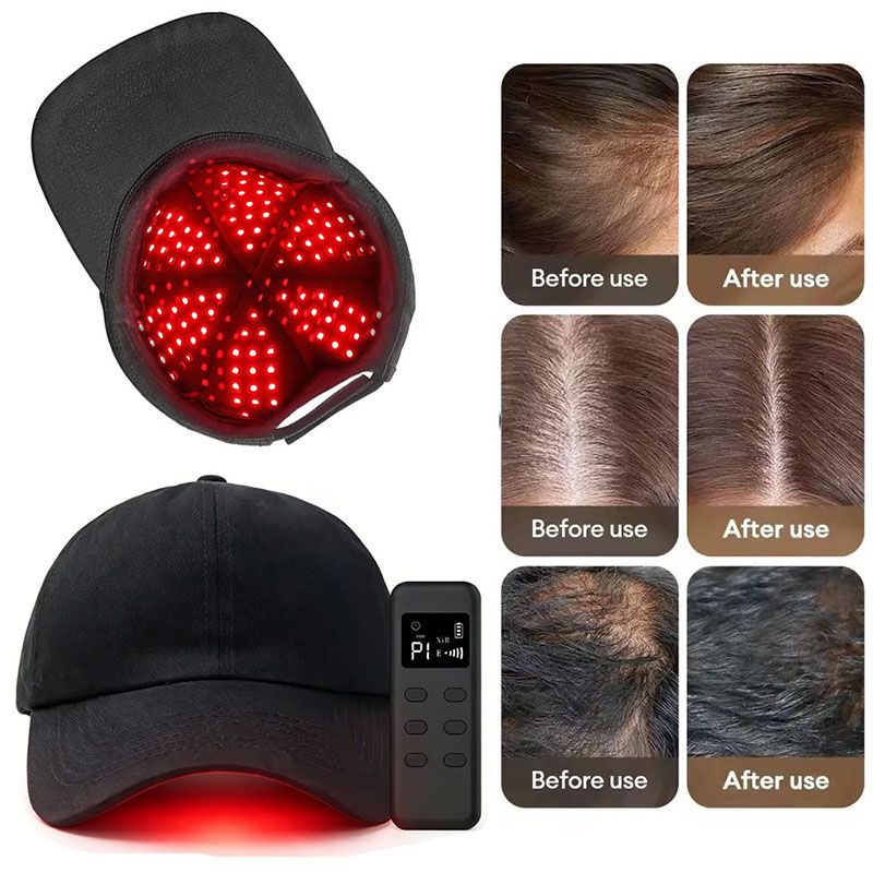 660nm 940nm Light 142 Groups / - đánh giá và giá Hair Care Wella